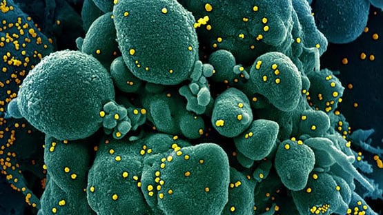 हल्के लक्षण वाले कोरोना पॉजिटिव युवाओं को 3 हफ्ते बाद भी होती हैं दिक्कतें