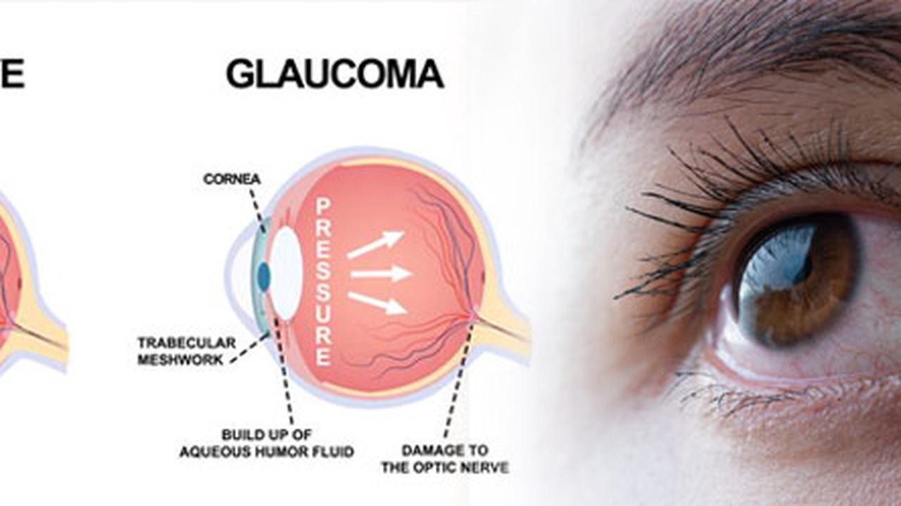 Glaucoma Destroying People’s Vision