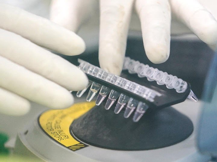 Cellules Souches Du Sang Du Cordon Ombilical Faq Nouvelles Du Monde