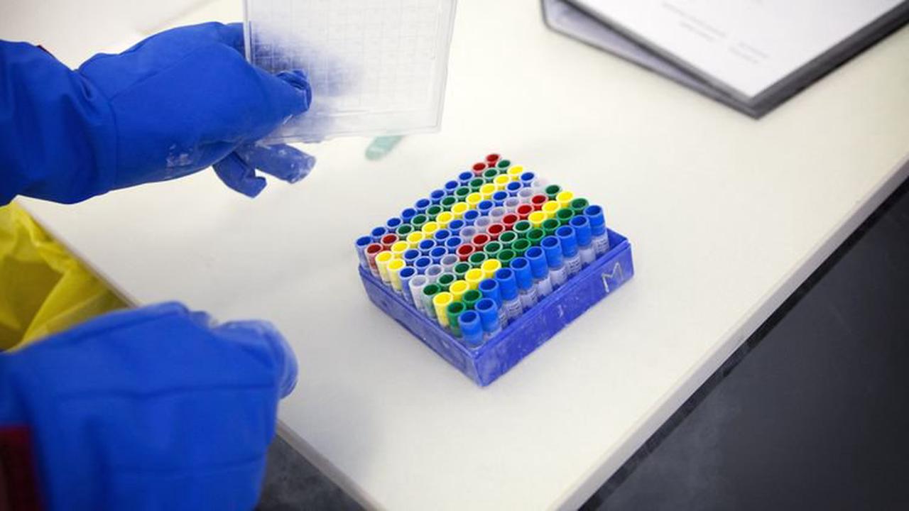 Moderna a commencé des essais sur les humains d'un vaccin contre le VIH utilisant l'ARN messager