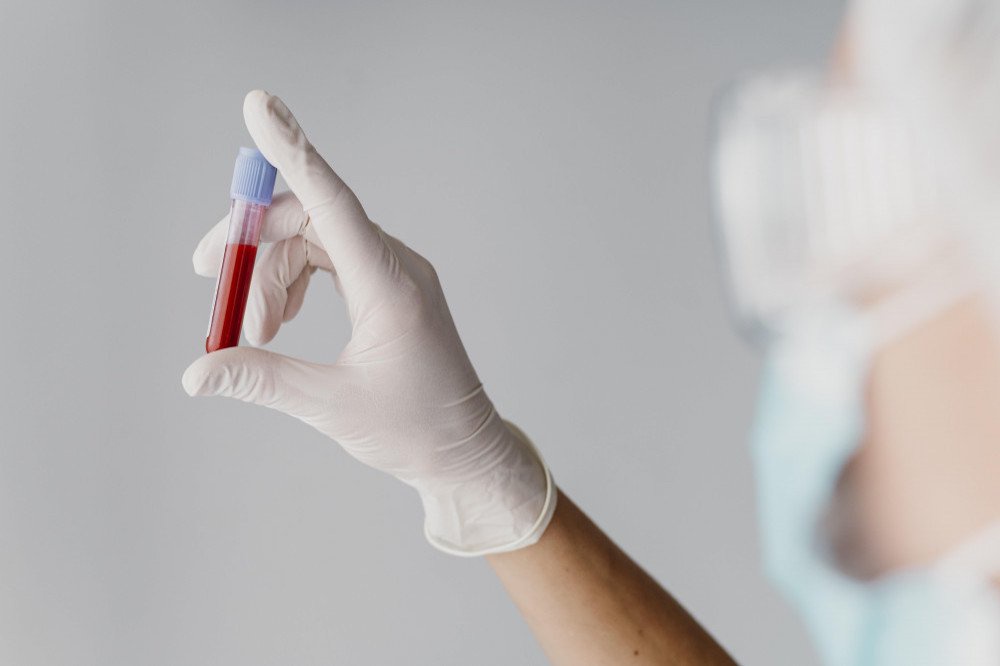Doctors have warned that the viral 'ferritin face' trend is no substitute for a blood test