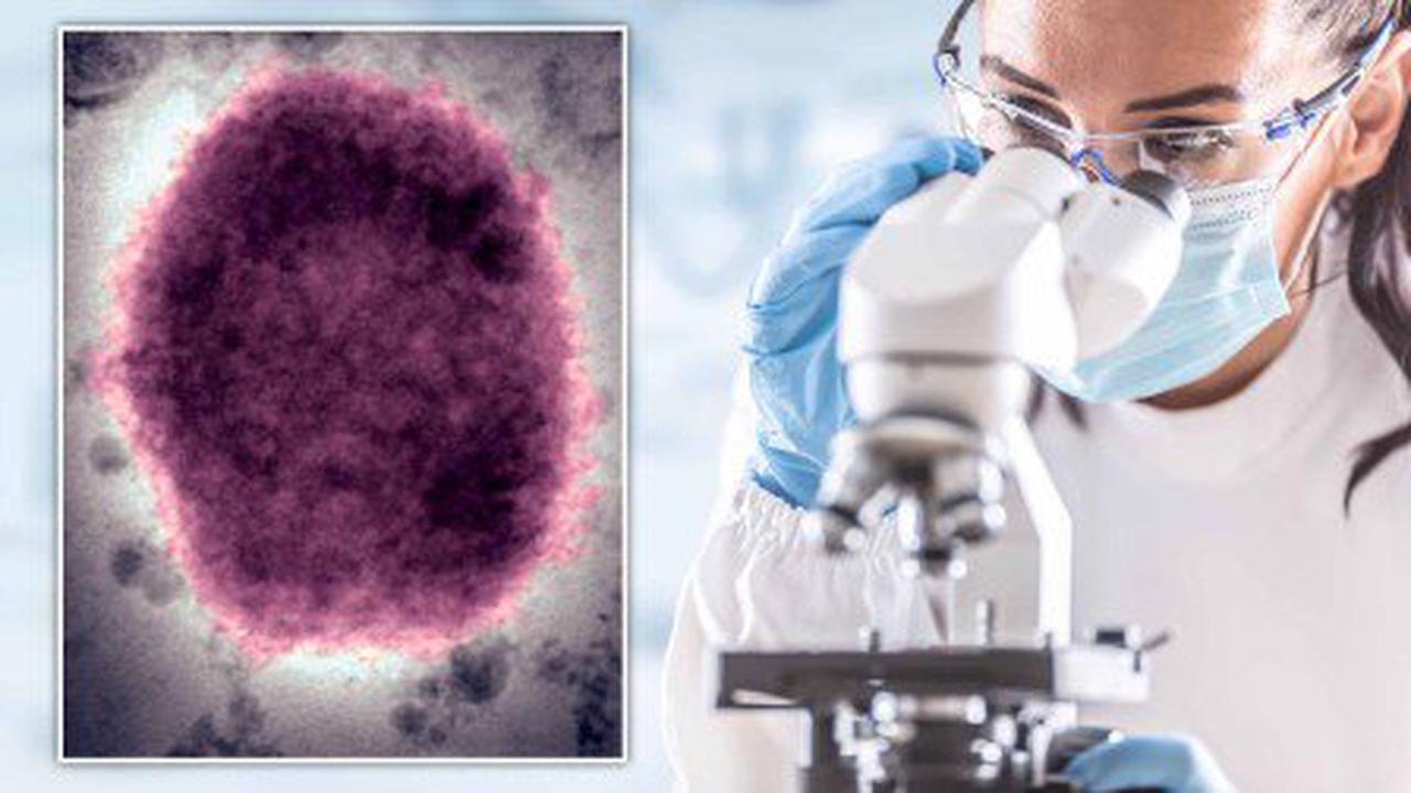 Belgium introduces 21-day quarantine for all monkeypox cases