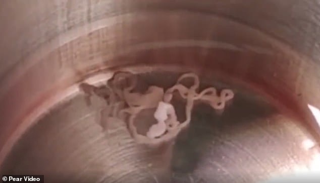 Revolting footage captures the white, slender parasite wiggling and moving around inside a container after it has been removed from the patient