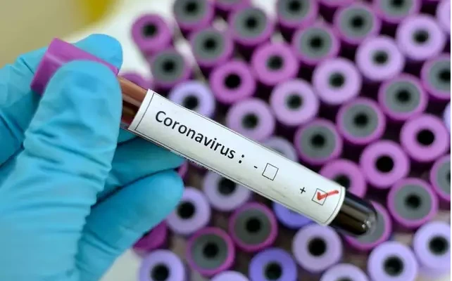 Coronavirus: Nigerians Alledgedly Mobs Pharmacies to buy Chloroquine Drugs