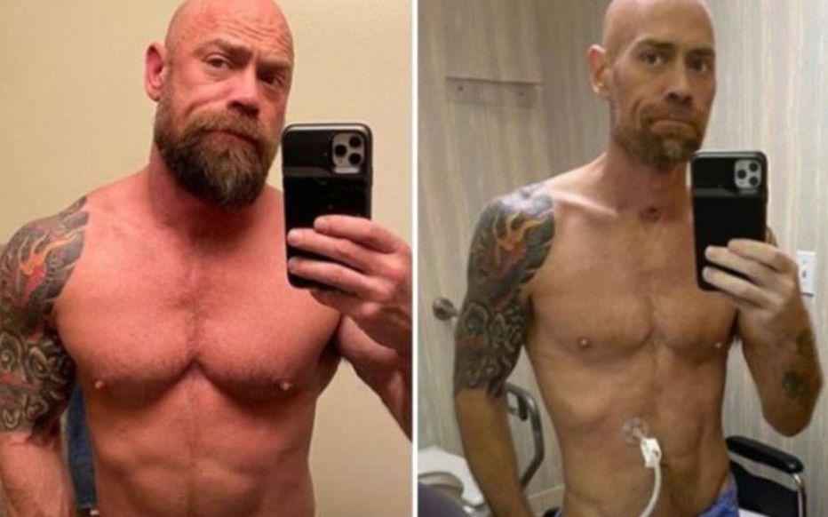  Mike Schultz, un infirmier américain de 43 ans, a été contaminé par le Covid-19. Après « six semaines sous ventilation et intubation », il a posté deux photos de lui, avant et après.