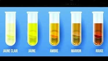 La Couleur Des Urines Et Sa Signification Toute Lactualité