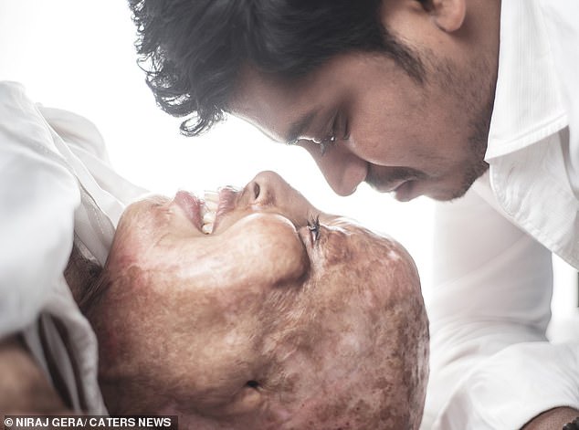 Woman, 28, who survived acid attack after rejecting a marriage proposal at 15, marries a man she met while in hospital (Photos)