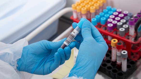 Blood Biomarkers May Help Identify Alzheimer's Disease Risk Early