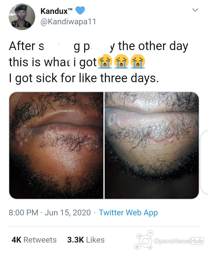 see what happened to a twitter user's mouth after licking a lady's 'ToTo'