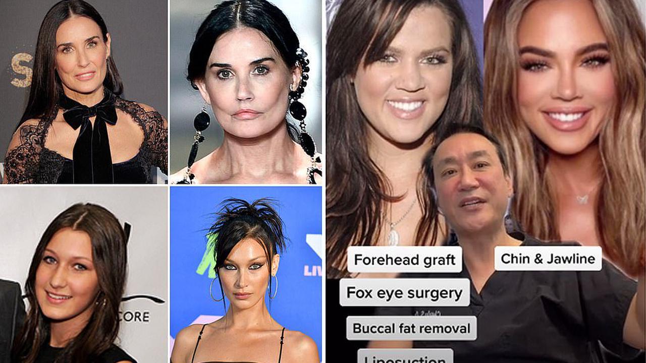 Plastic surgeon reveals which A-listers - from Bella Hadid to Khloé Kardashian